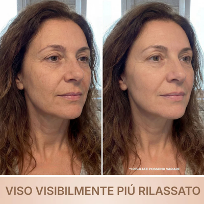 BioChroma • Siero Coreano Effetto Lifting dalla Prima Applicazione