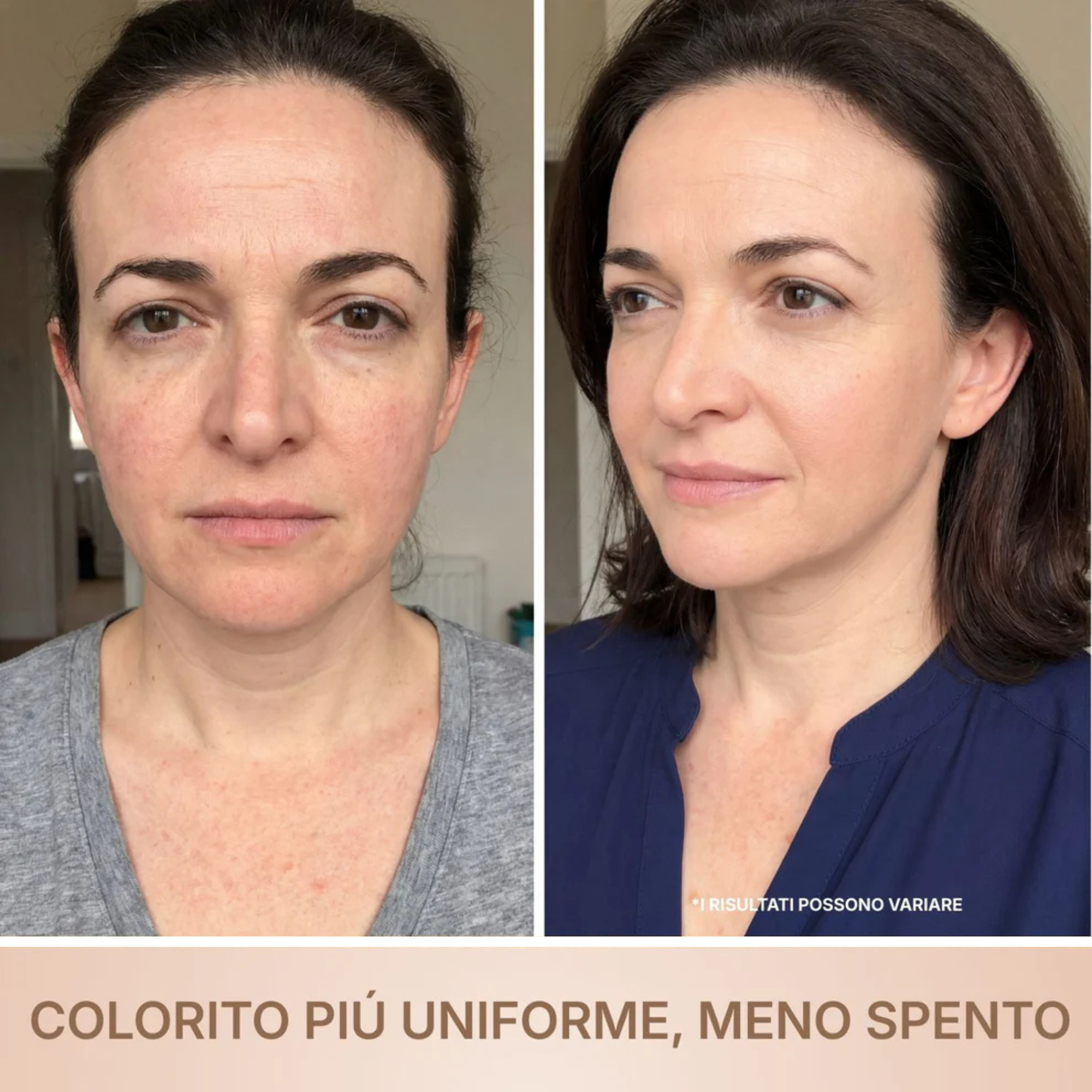 BioChroma • Siero Coreano Effetto Lifting dalla Prima Applicazione