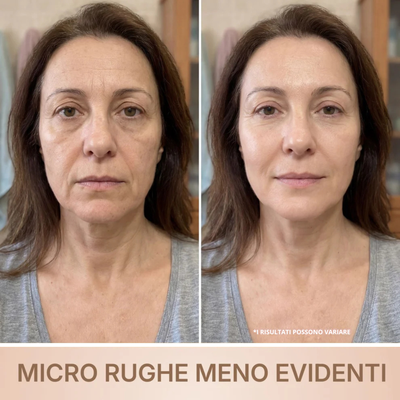 BioChroma • Siero Coreano Effetto Lifting dalla Prima Applicazione