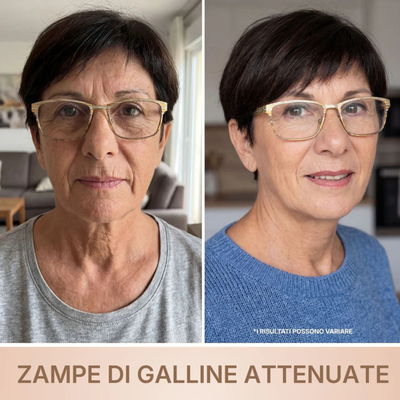BioChroma • Siero Coreano Effetto Lifting dalla Prima Applicazione