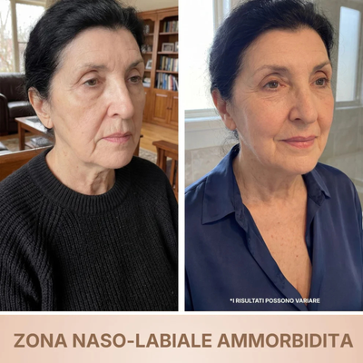 BioChroma • Siero Coreano Effetto Lifting dalla Prima Applicazione
