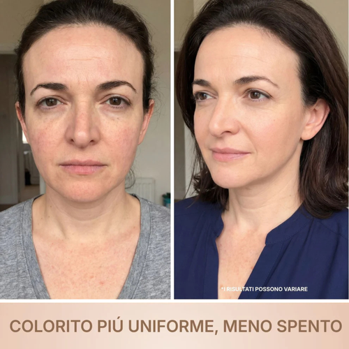 BioChroma • Siero Coreano Effetto Lifting dalla Prima Applicazione